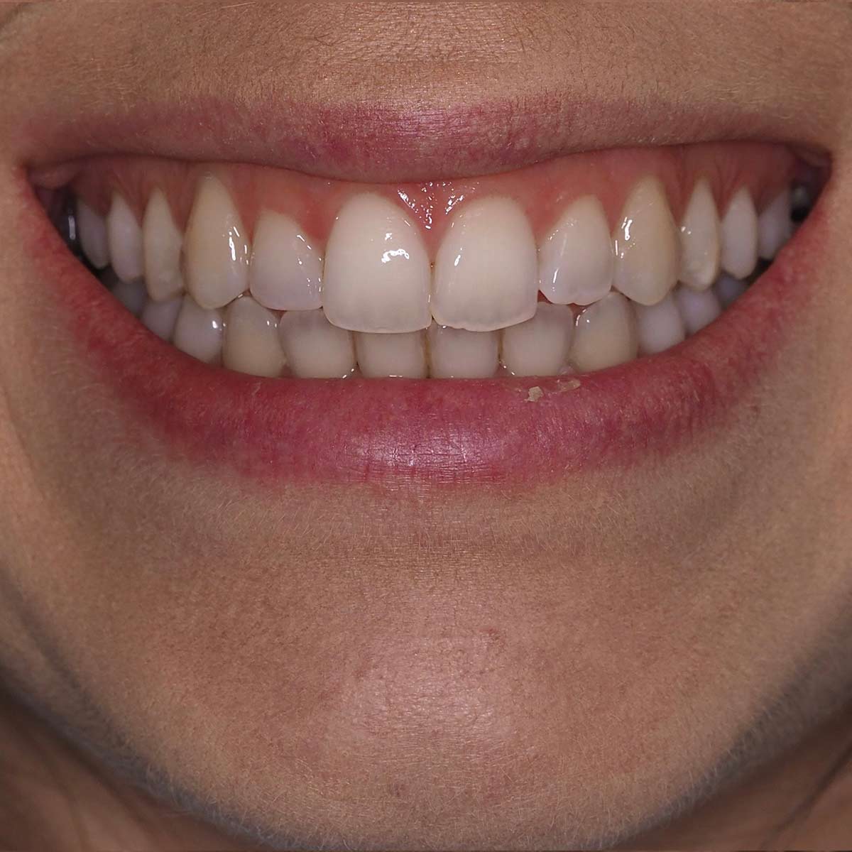 Before image