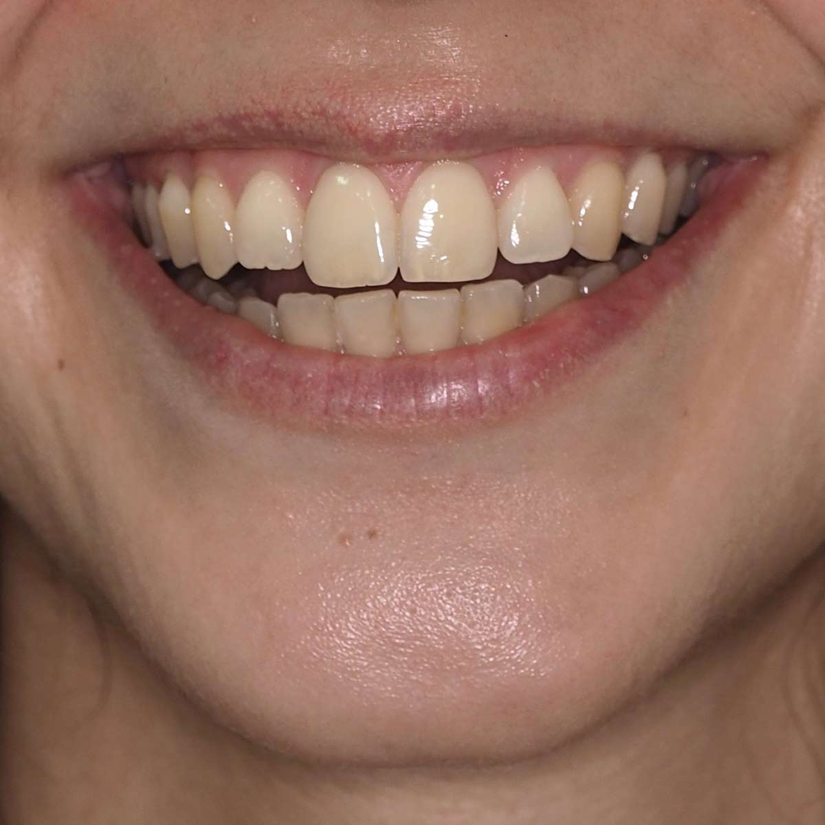 Before image