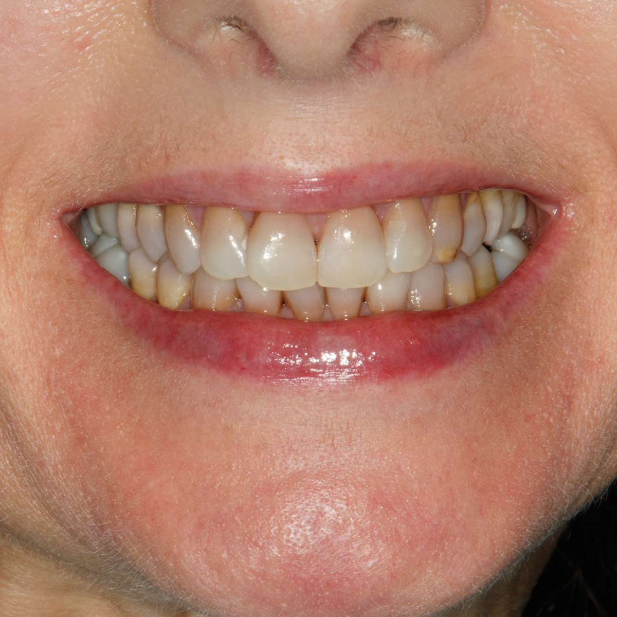 Before image