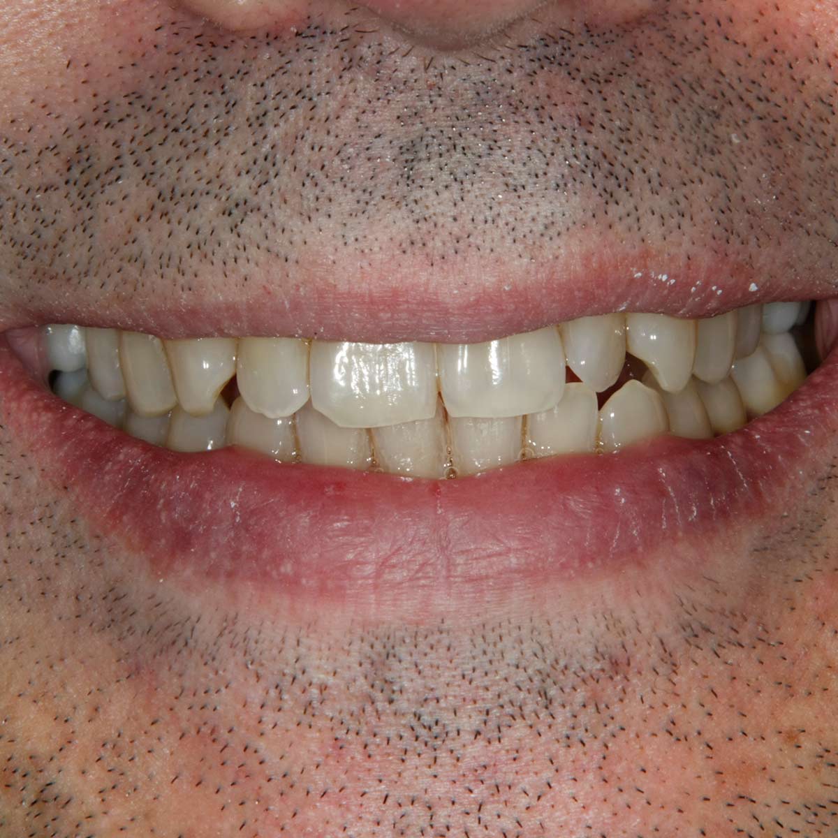 Before image