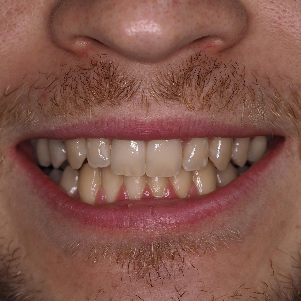 Before image