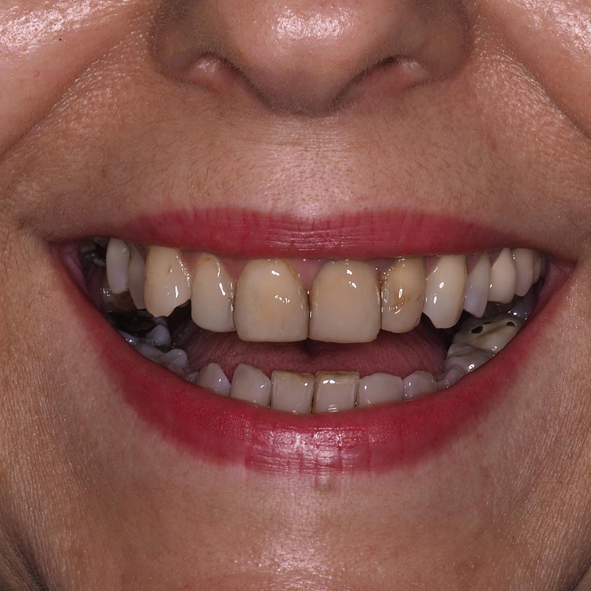 Before image