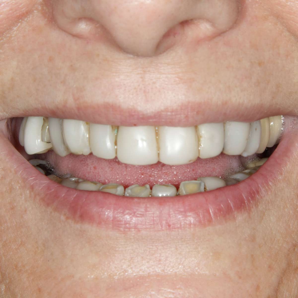 Before image