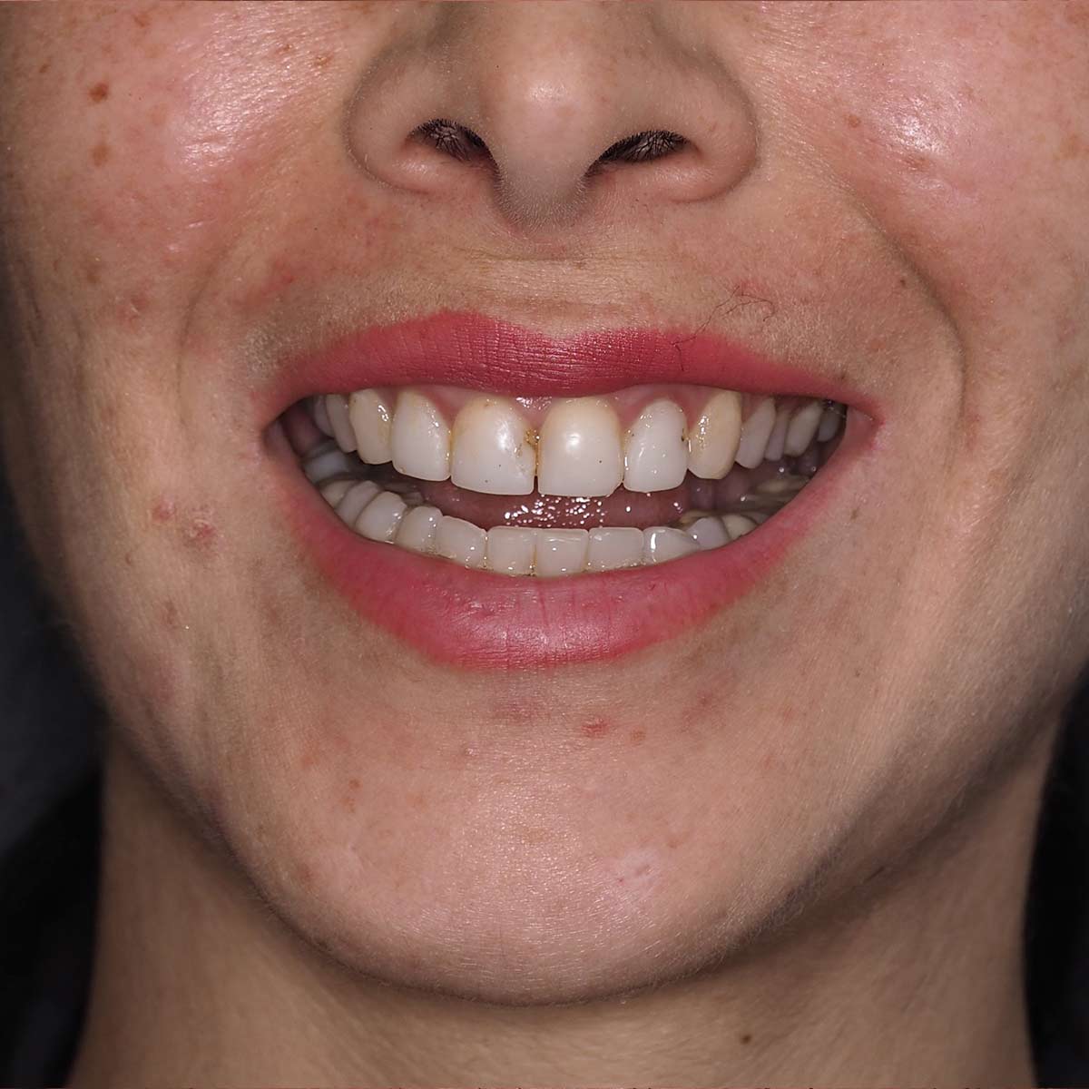 Before image