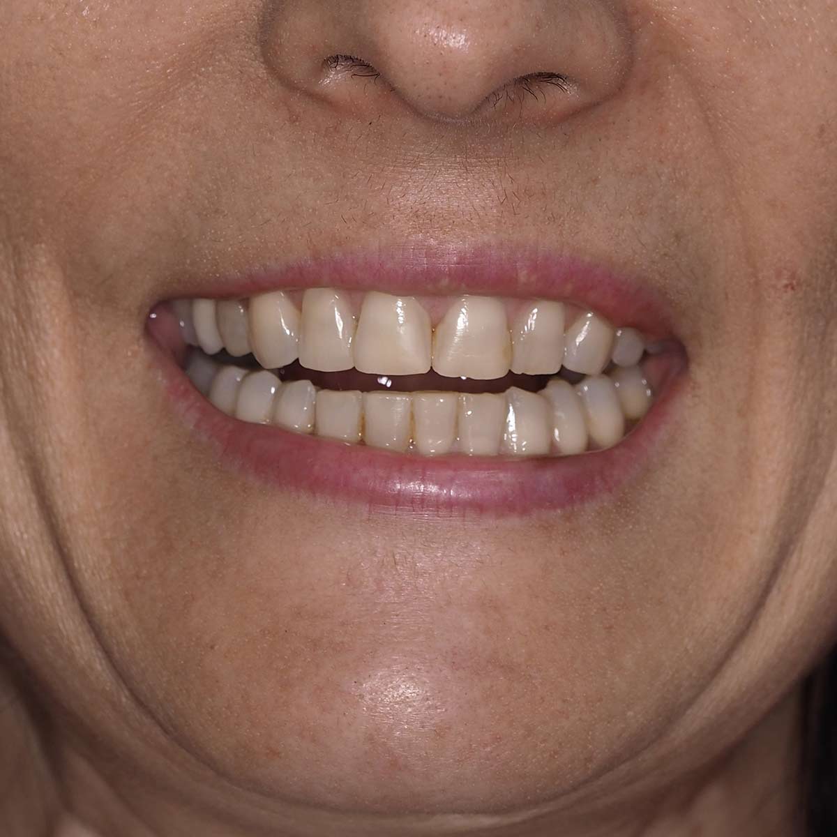 Before image