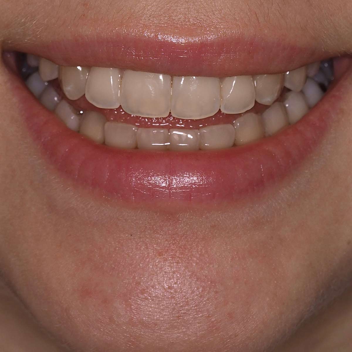 Before image
