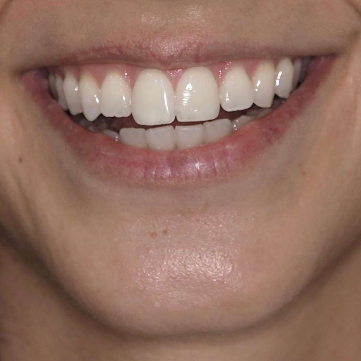 After image