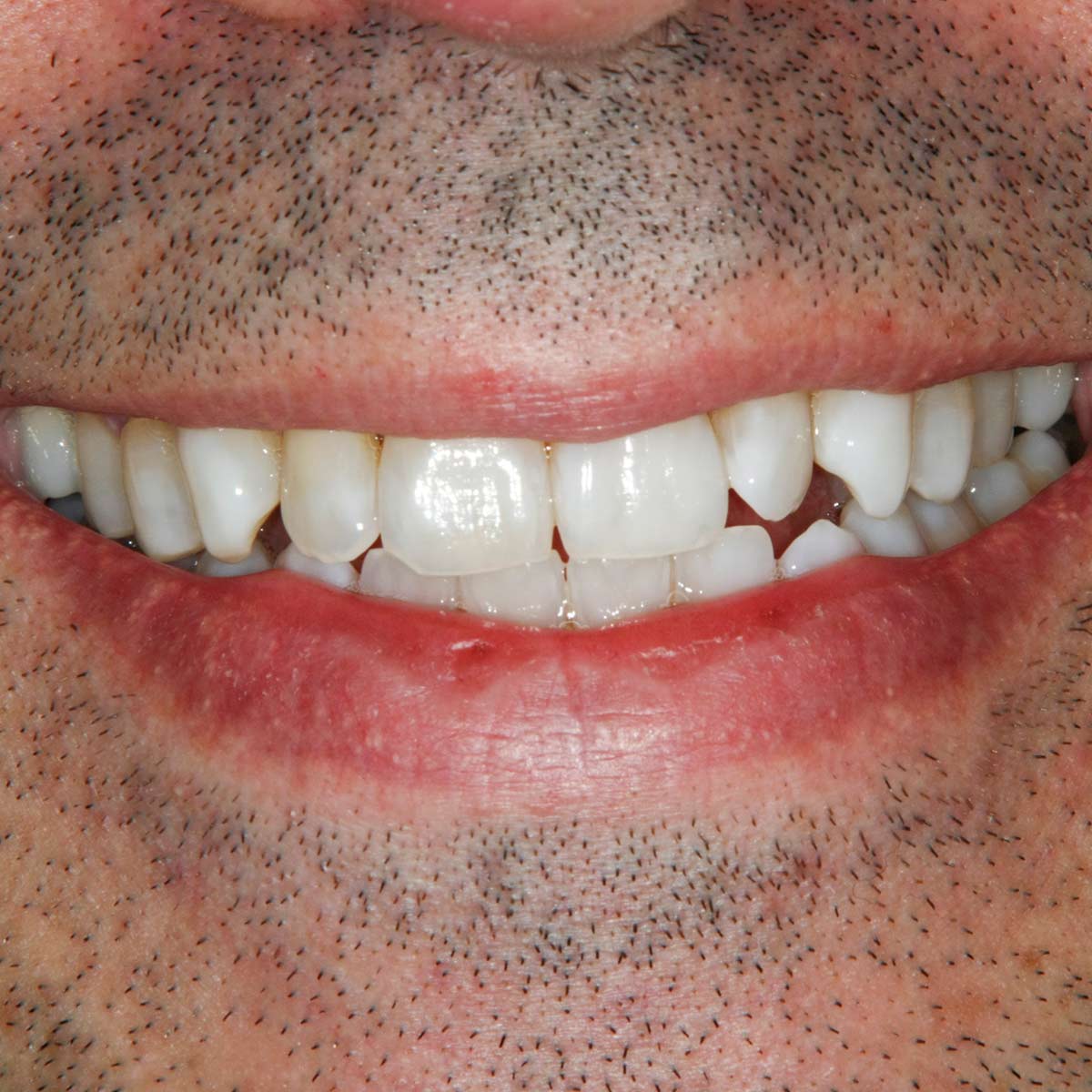 After image