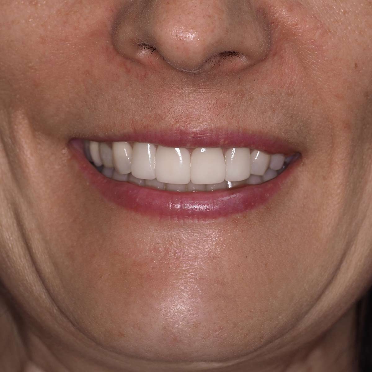 After image