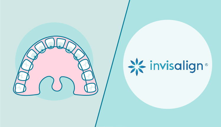 ortodoncia lingual o invisalign|tratamiento ortodoncia invisalign y lingual|diferencias ortodoncia lingual o invisalign