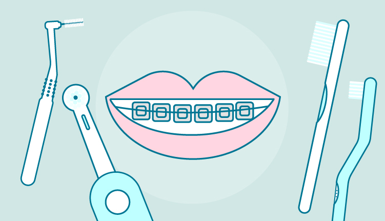 |cepillo-de-dientes-para-ortodoncia
