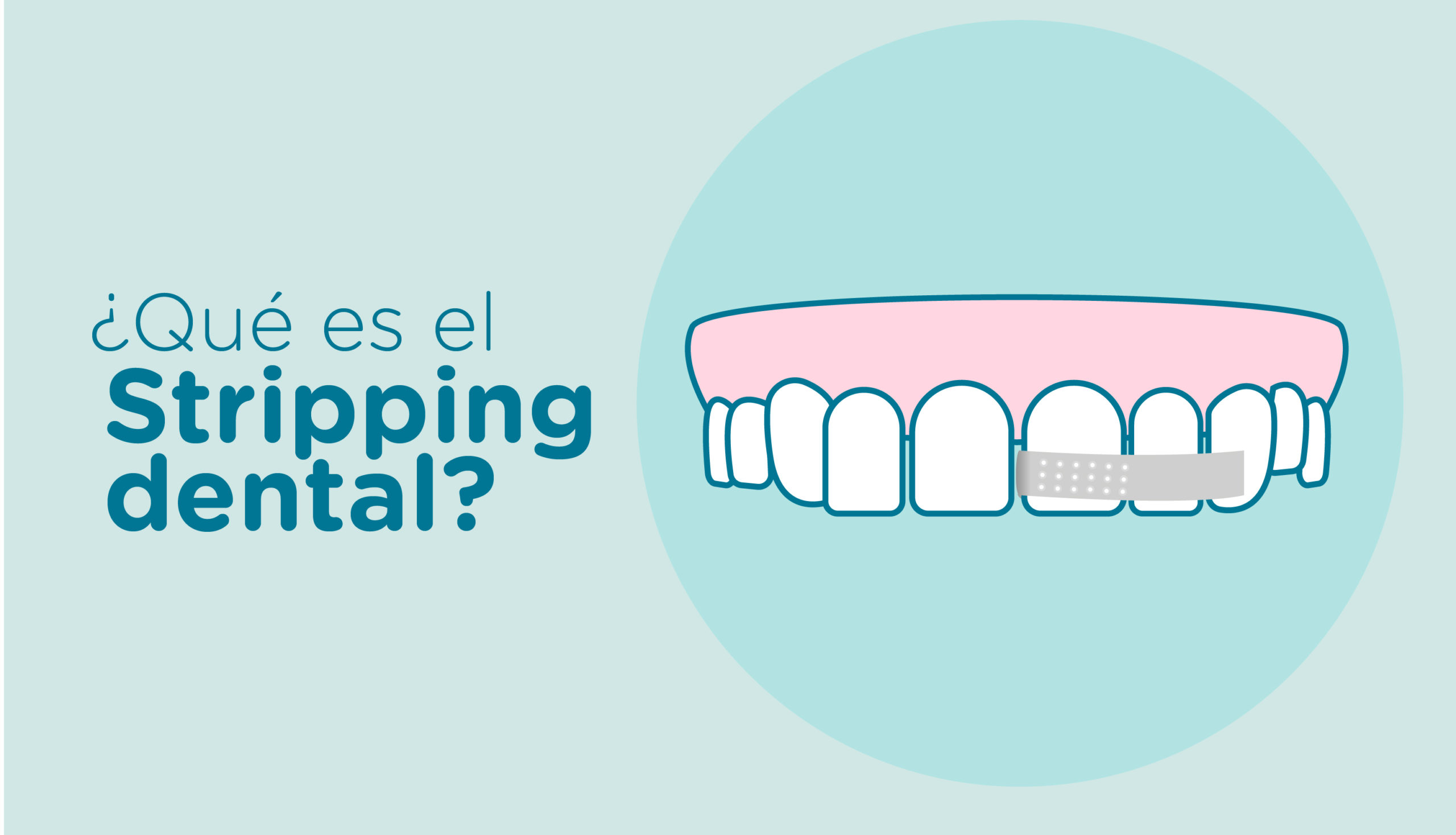 stripping-dental|stripping-ortodoncia