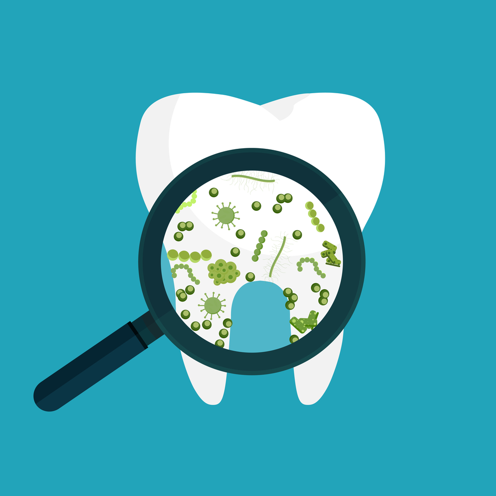 Enfermedades de la boca|Caries Dental Antes y después del tratamiento|Lengua blanca por candidiasis|Llaga