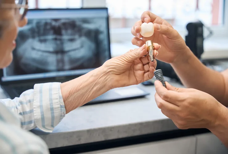 tipos de implantes dentales