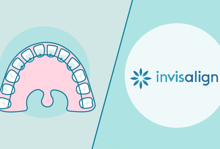 ortodoncia lingual o invisalign|tratamiento ortodoncia invisalign y lingual|diferencias ortodoncia lingual o invisalign