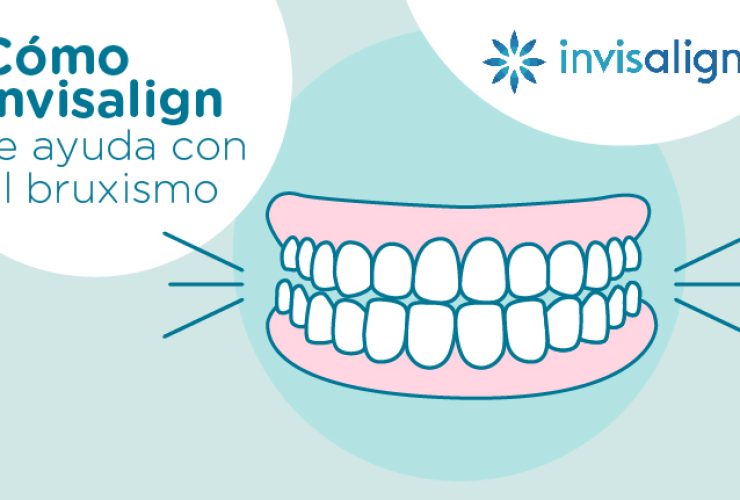 invisalign-bruxismo||bruxismo