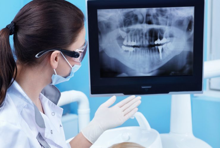 Rayos X boca paciente consulta dentista|Consult dentista. Colocación de brackets|Análisis cavidad bucal con escáner 3D
