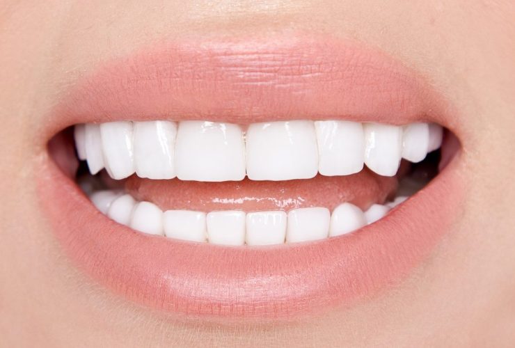 Dientes perfectos
