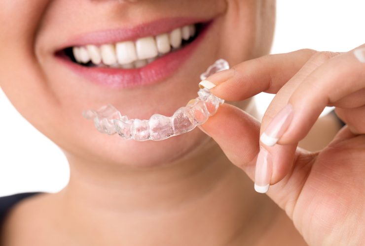 Férula dental transparente|Ortodoncia lingual estética de paciente en consulta|Consulta dentista estudio odontológico mandíbula