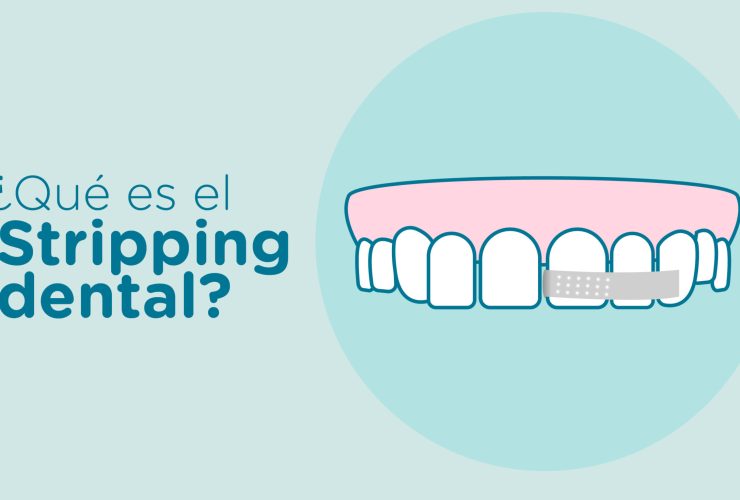 stripping-dental|stripping-ortodoncia