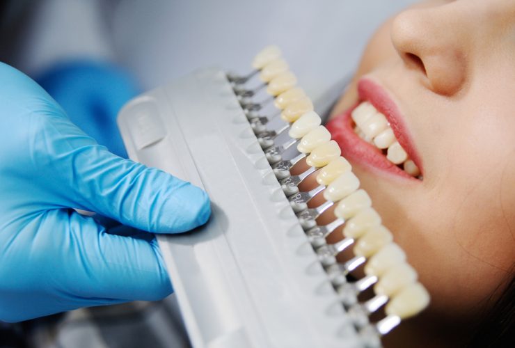 Dentista eligiendo color de la corona con paciente mujer