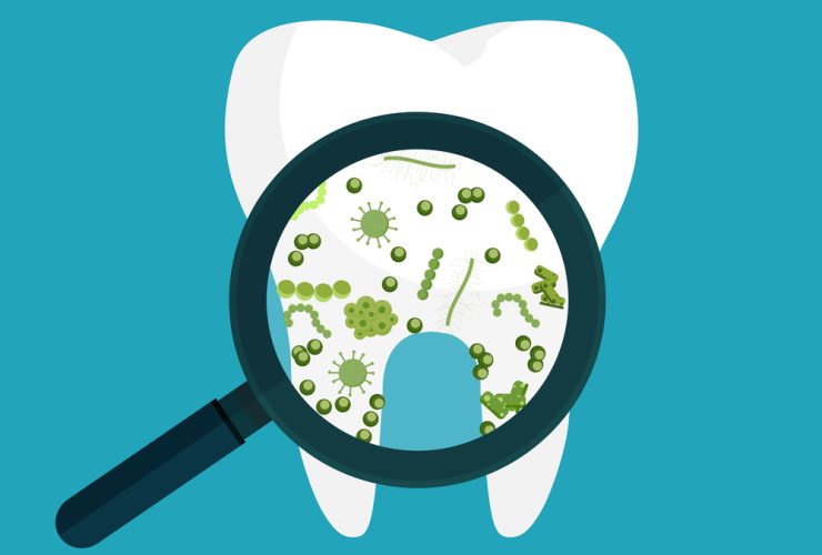 Enfermedades de la boca|Caries Dental Antes y después del tratamiento|Lengua blanca por candidiasis|Llaga