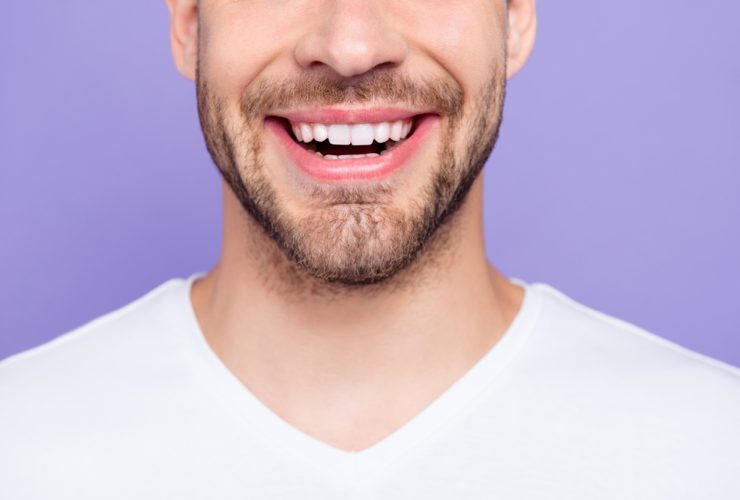Boca de hombre con carillas dentales