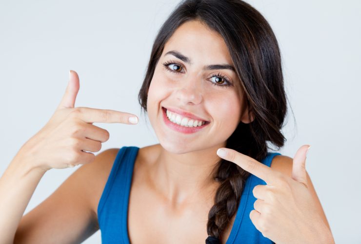 Sonrisa con carillas dentales